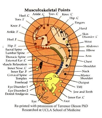 La Auriculoterapia 